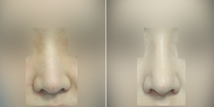 Slider image (5) MISOU Plastic Surgery